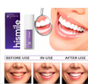 HISMILE - BLANQUEADOR DENTAL PREMIUM V34